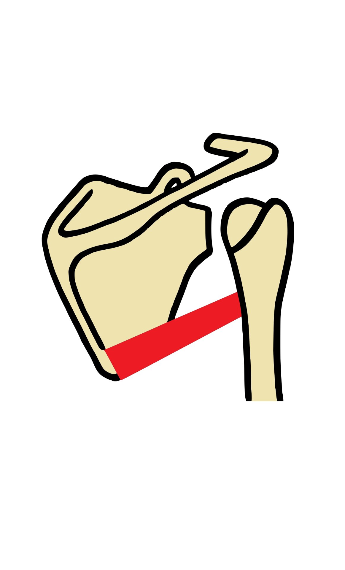 Ceinture Scapulaire images Flashcards Memorang