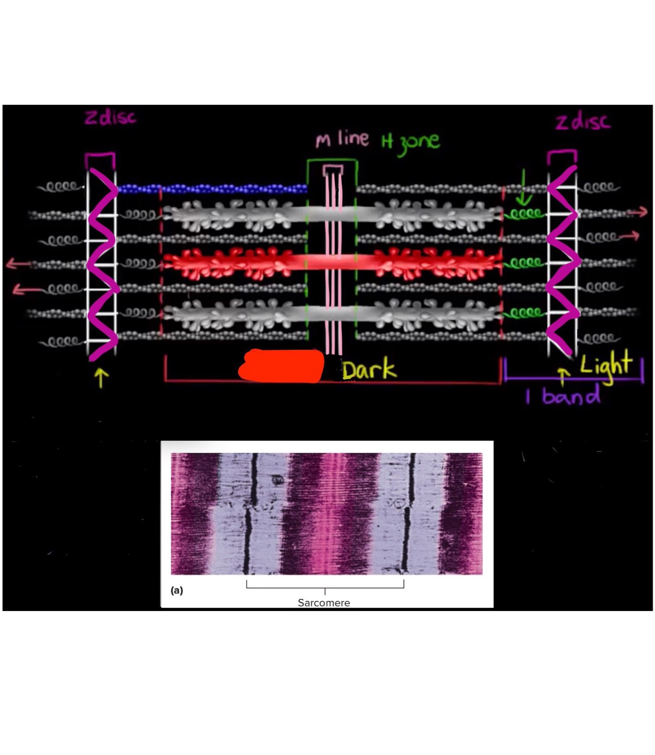The Definitive Guide To Sarcomere Labeling - acvmc6w