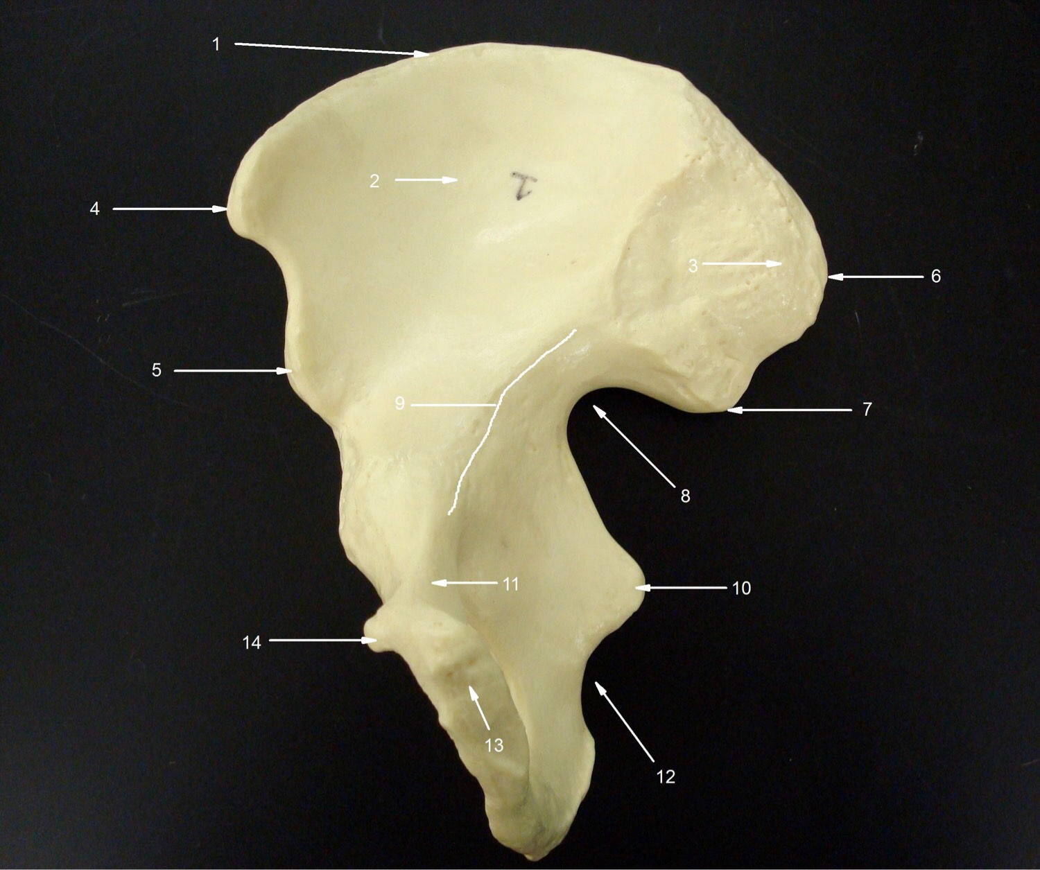 Appendicular Skeleton Flashcards | Memorang