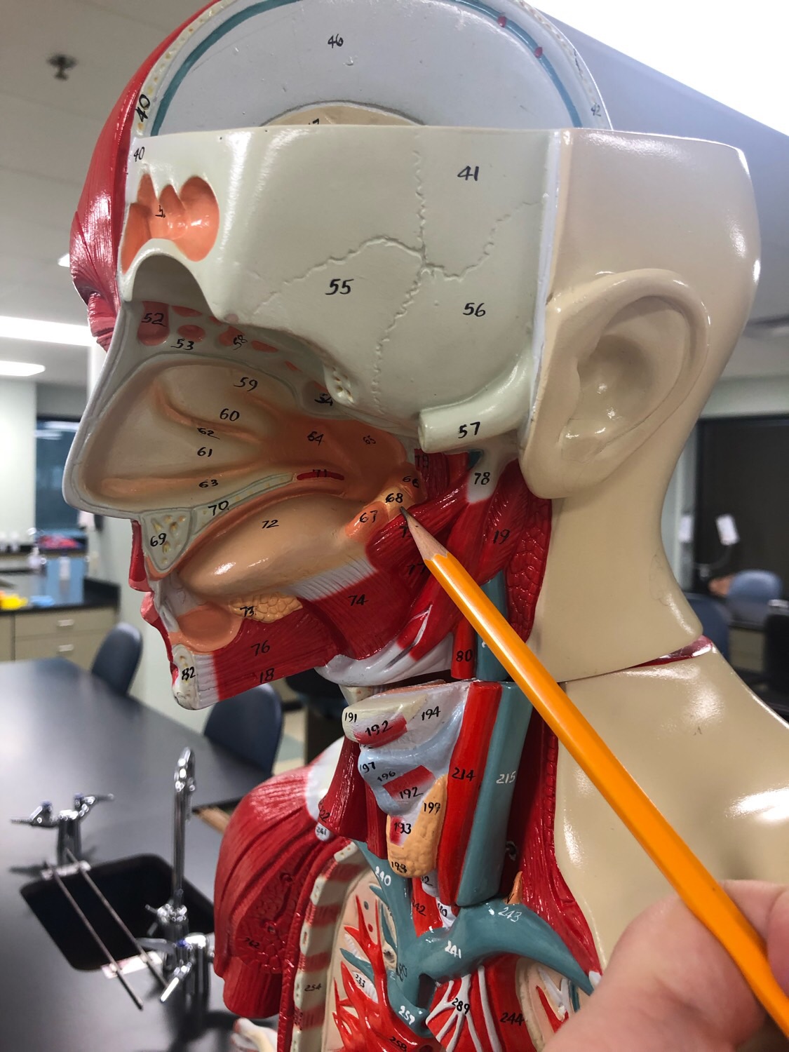 Ap2 Lab Lymphatic System Flashcards Memorang