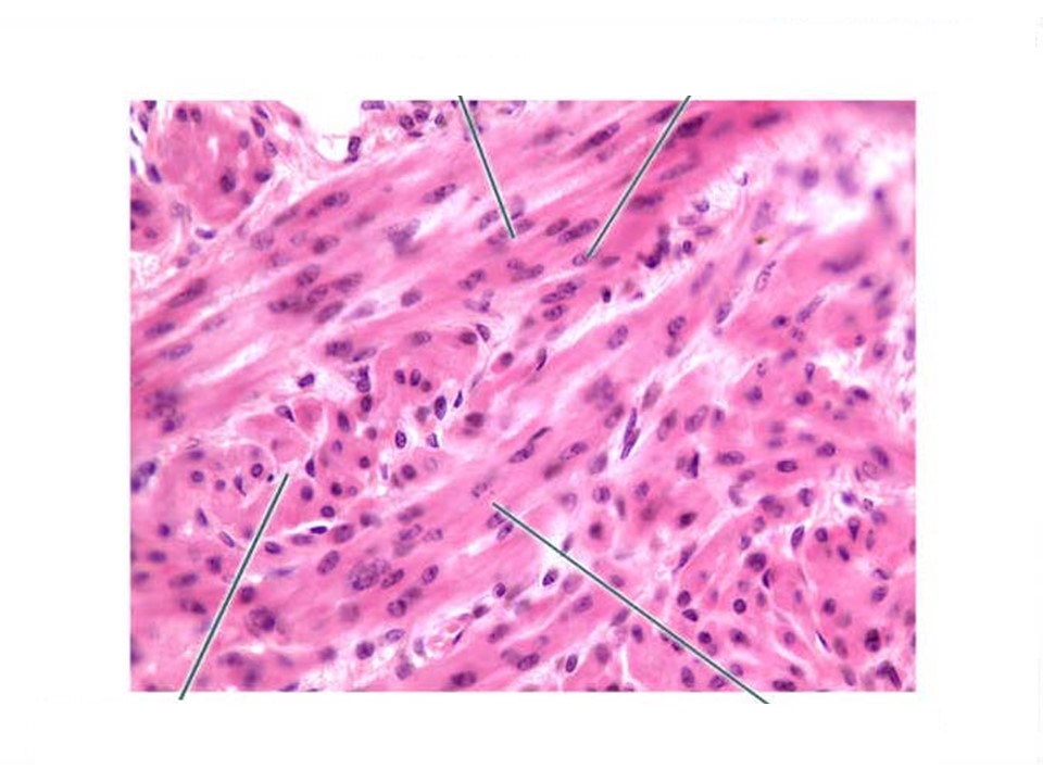 Muscle Tissue/Nervous Tissue (EXAM 1) LAB1 Flashcards Memorang