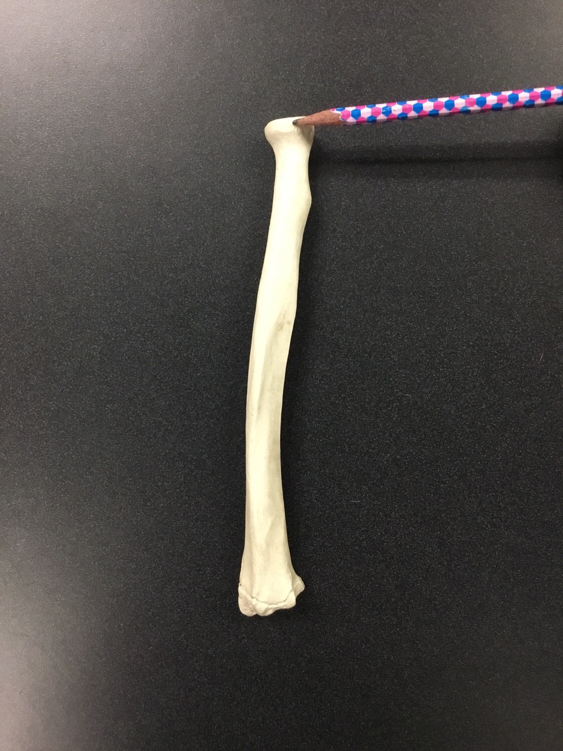 Right radius and ulna Flashcards Memorang