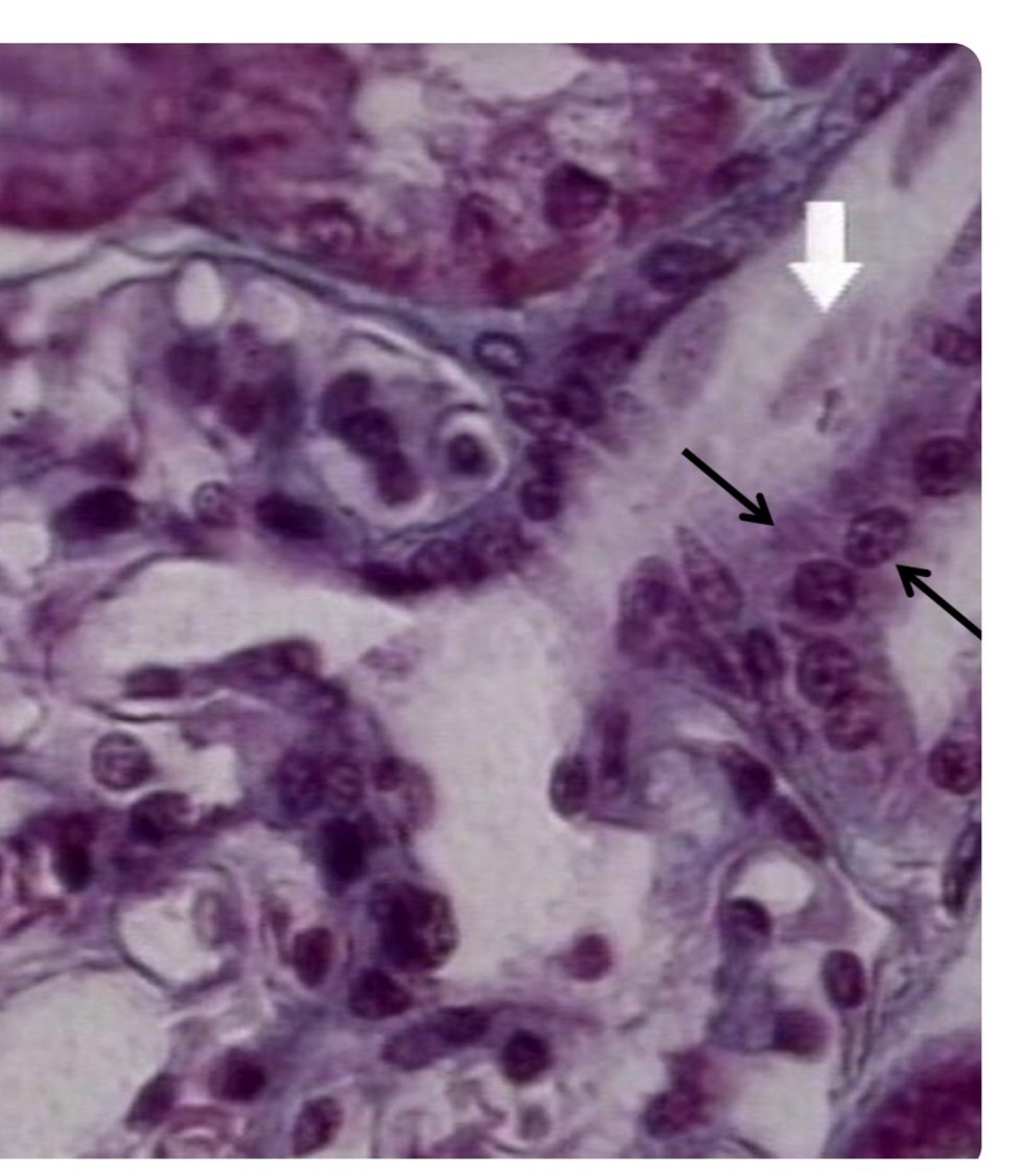 Urinary System Flashcards Memorang