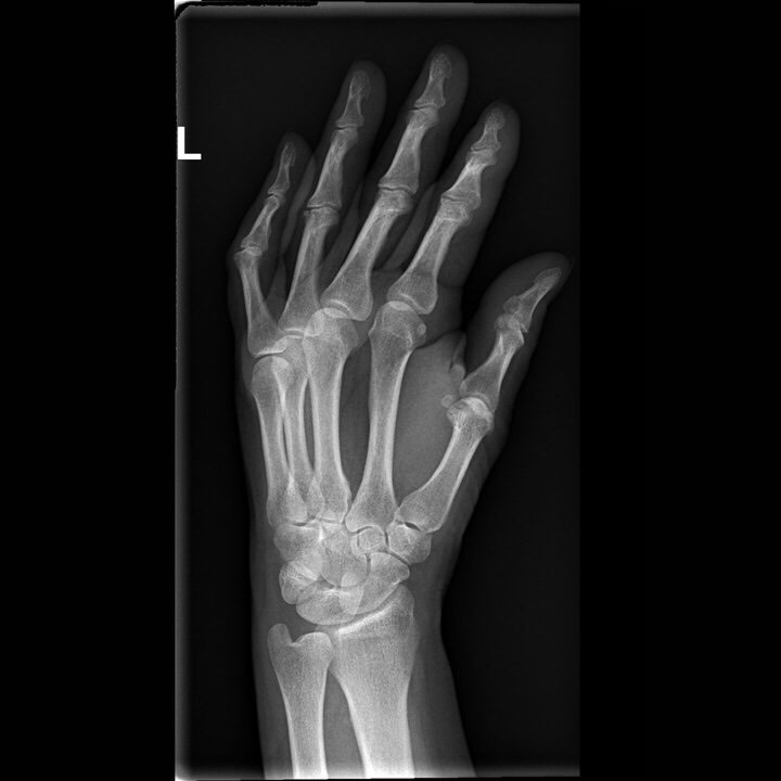 DR Radiography Quiz General Flashcards Memorang