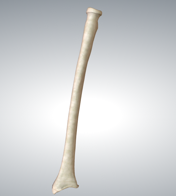 Radius Bone Markings Flashcards Memorang