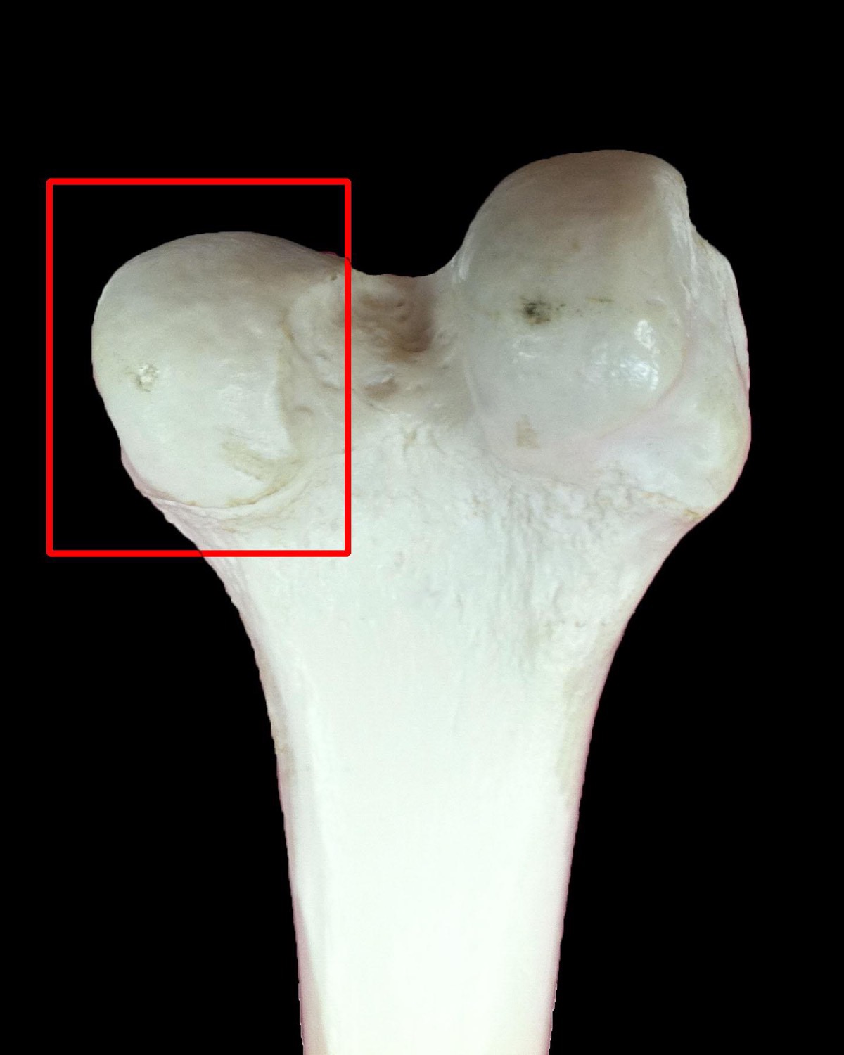 Bone Descriptions Flashcards Memorang