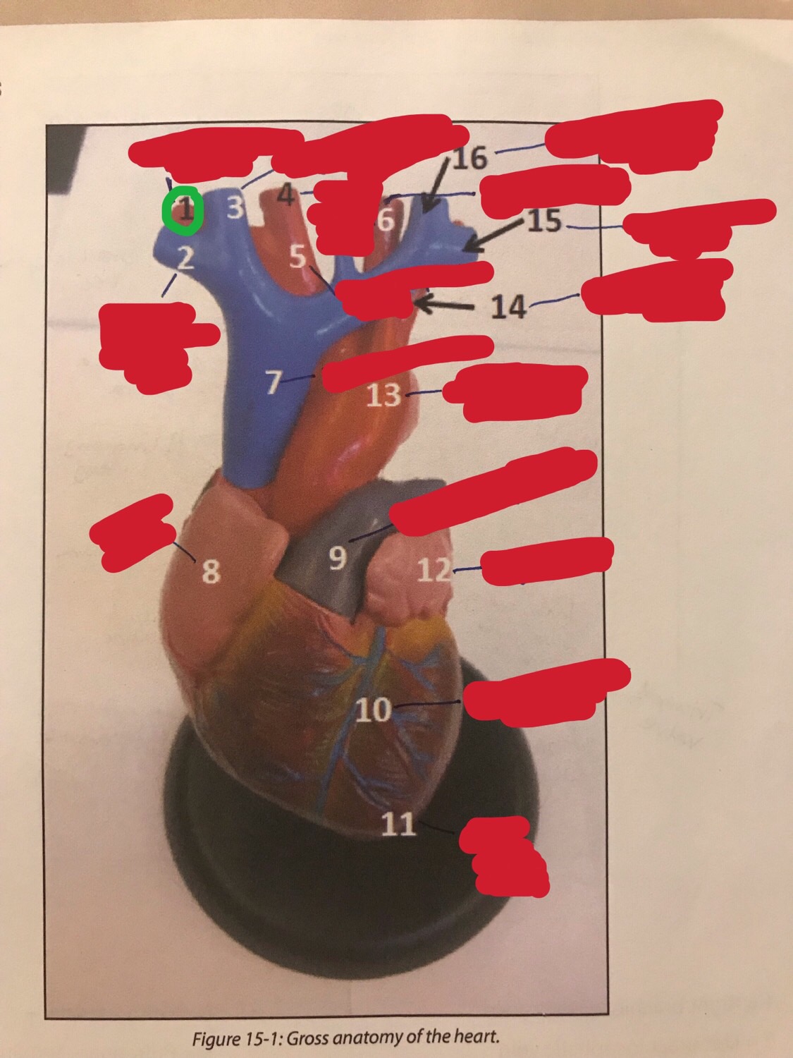 Gross Anatomy of the Heart Flashcards | Memorang