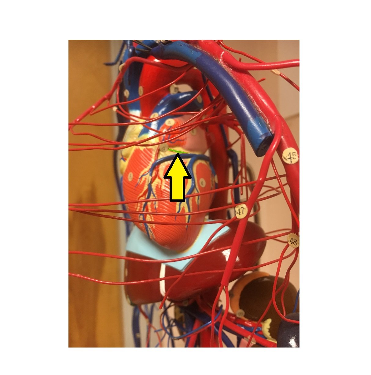A P 2 Arteries Wireman Flashcards Memorang
