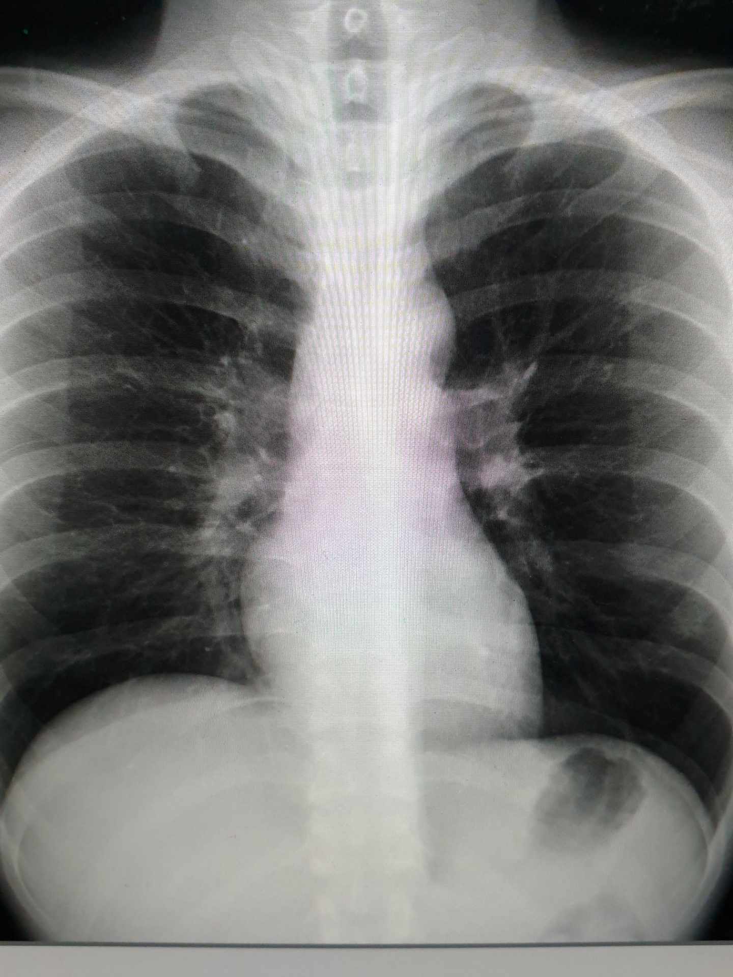 RADIOLOGY Flashcards Memorang