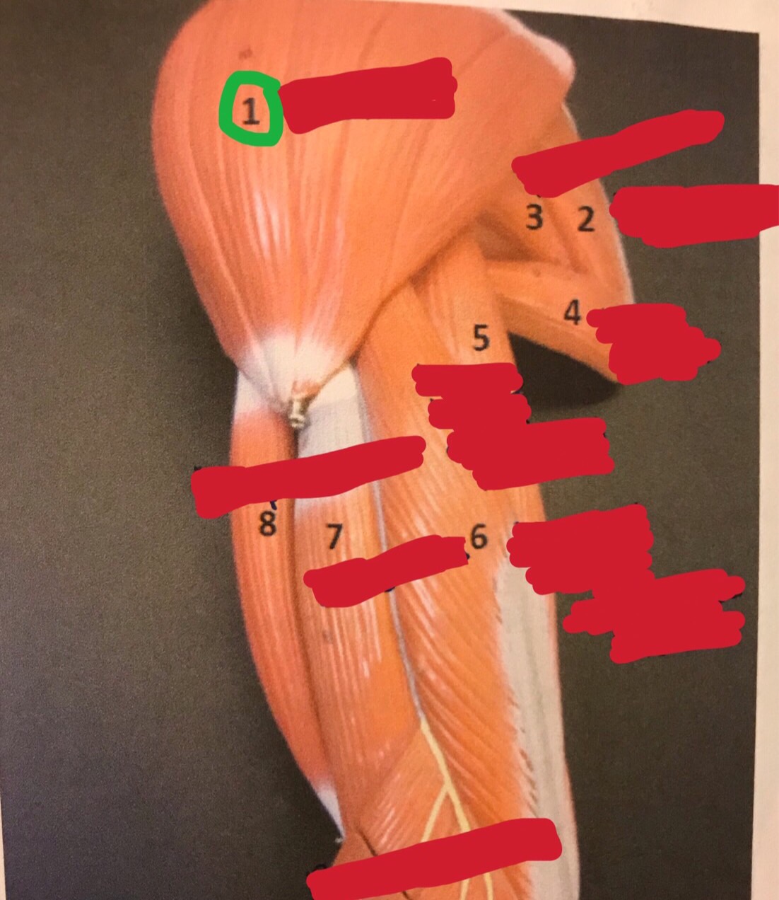 Post. Shoulder, Rotator Cuff, Pec Girdle, Arm & FA Flashcards Memorang