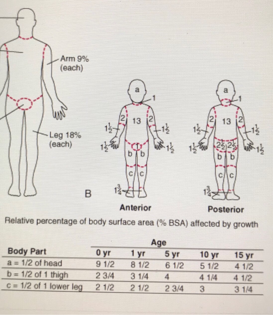 Burns Flashcards Memorang