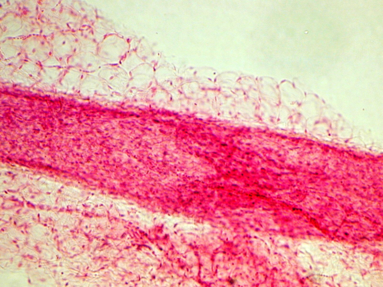 Lymphatic System Flashcards Memorang