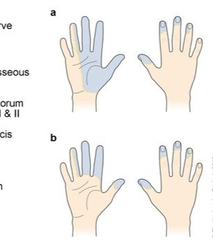 Neuro Andres Flashcards