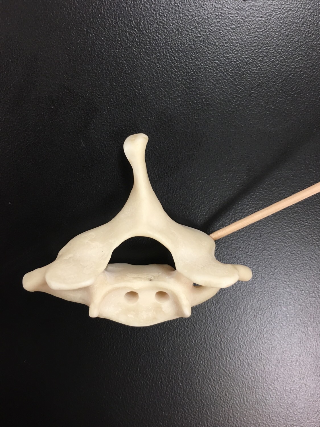 Individual Vertebrae Features Flashcards Memorang Individual Vertebrae Features Flashcards Memorang