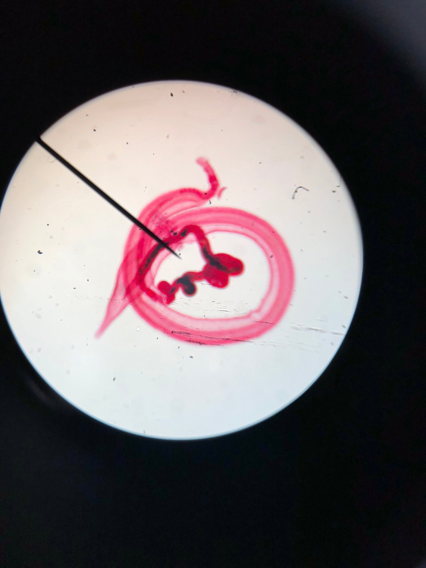 micro lab final bacteria pics helminths Flashcards Memorang