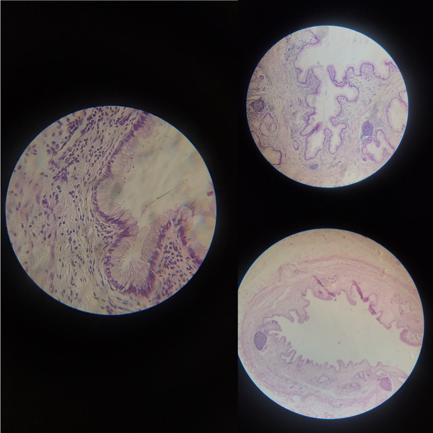 Cytology slides Flashcards Memorang