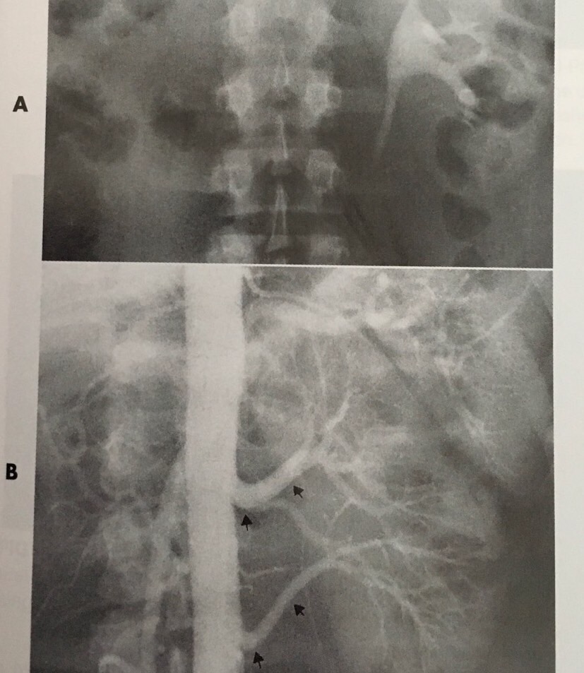 Urinary System Pathologies Flashcards Memorang