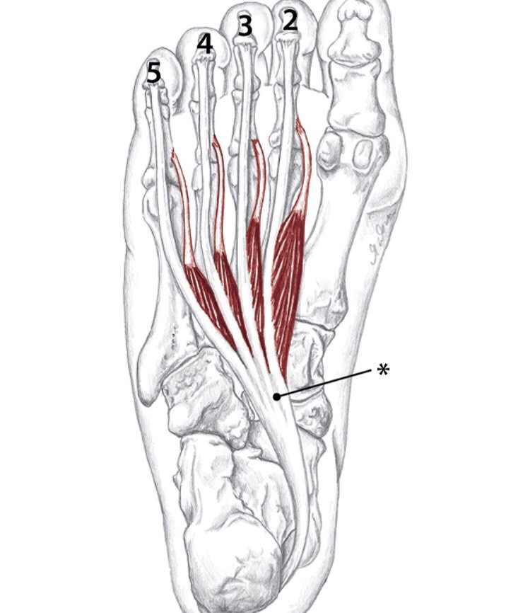 Plantar Fasciitis Muscles Flashcards Memorang