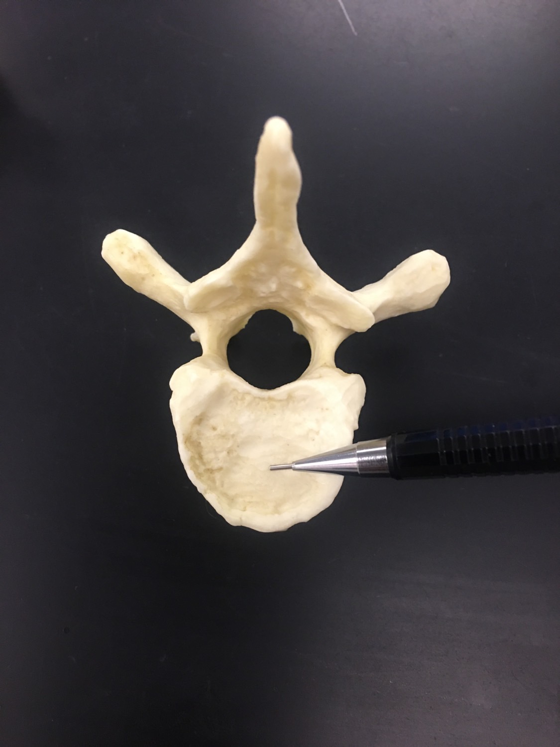 Spinal Column Flashcards | Memorang